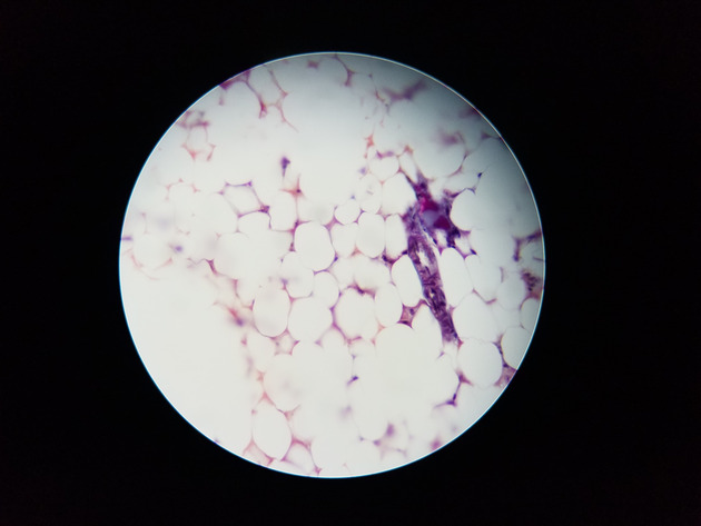 Adipose Connective Slides - Adipose Connective 01 400X